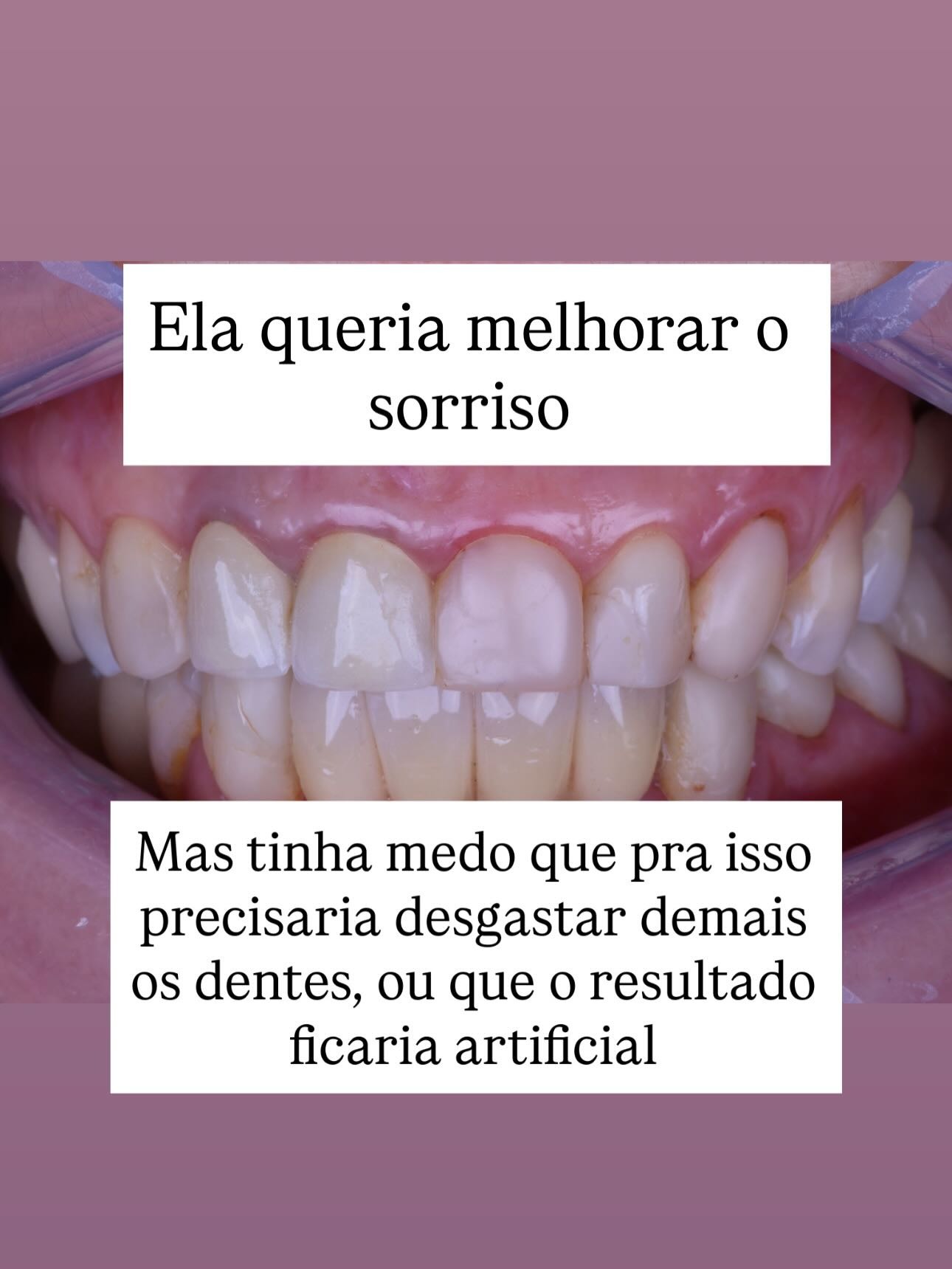 Novidade 5